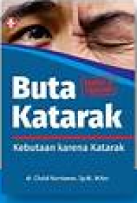 Image of Buta katarak : kebutaan karena katarak